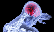 뇌 염증 행정 의료 건강 관리 신경과 고통 심리학 뼈 인간 해부학 해부