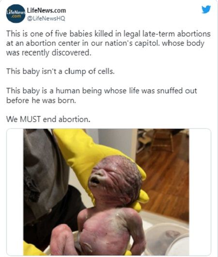 낙태된 태아 