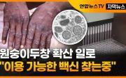 원숭이두창