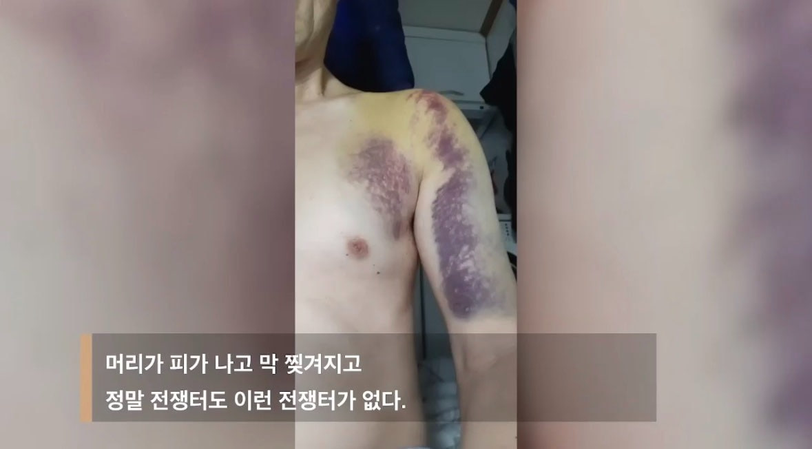 ▲사랑제일교회 측이 자신들의 피해 사실을 입증하기 위해 공개한 사진.