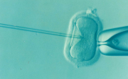 체외수정, 인공수정, IVF